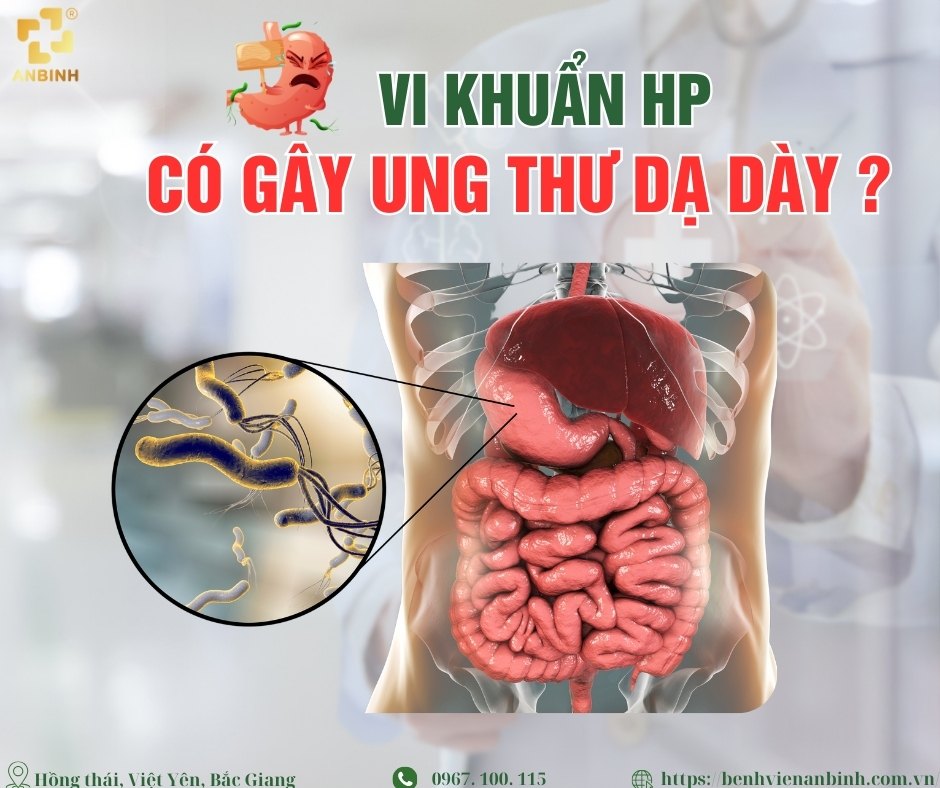 HP có gây ung thư dạ dày? Sự thật về vi khuẩn và nguy cơ sức khỏe